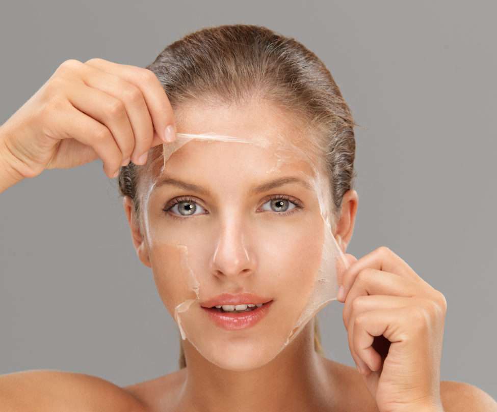 Ideal Candidate For Chemical Peel
